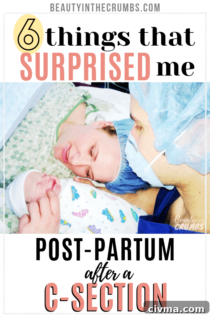 Tips tp recover from a c-section